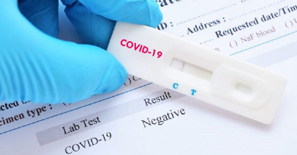 Covid-19 Antigen Rapid Test by Skinminded